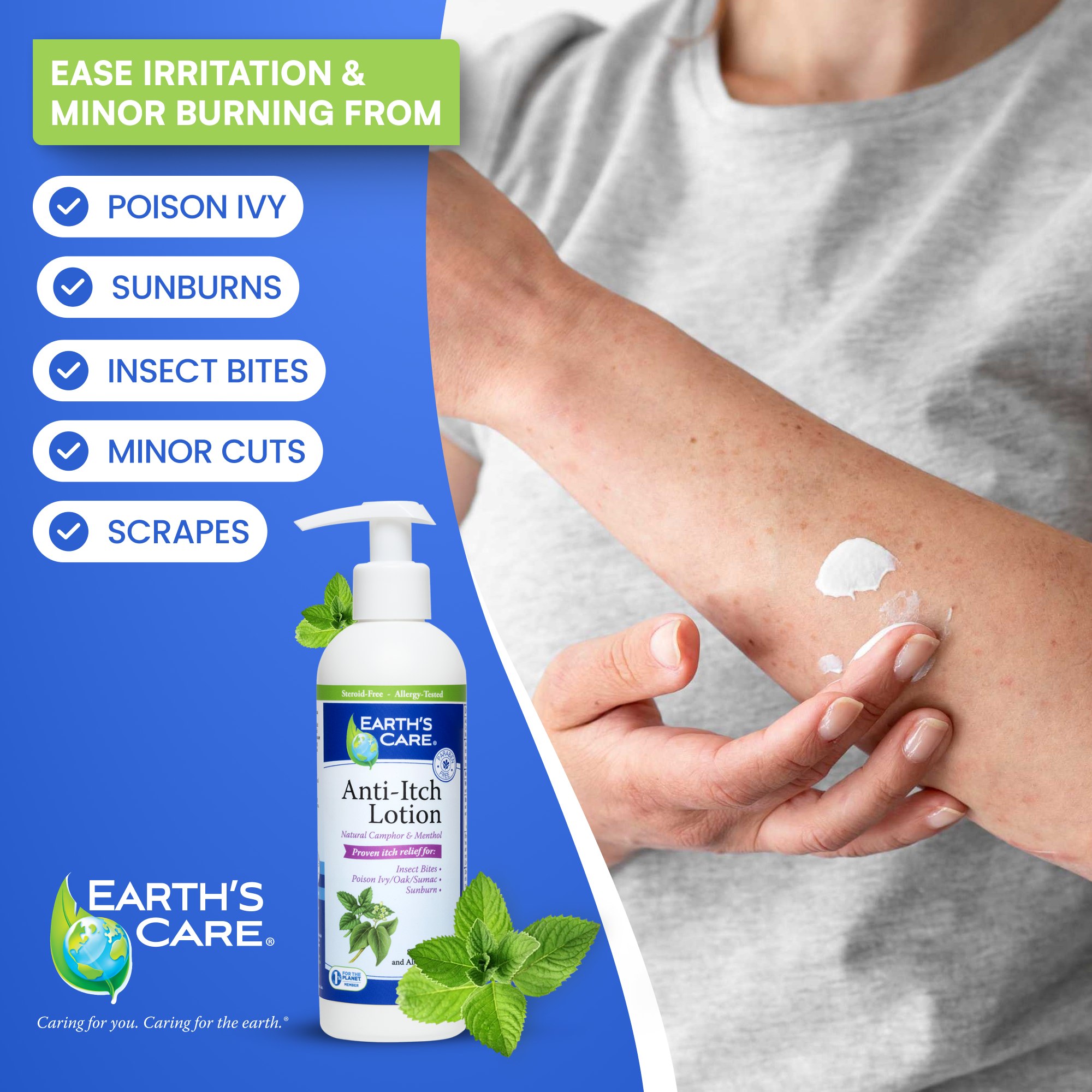 Earth's Care Anti-Itch Lotion bottle shown on a blue promotional graphic with a person applying white lotion to an arm. Text lists conditions like poison ivy, sunburns, insect bites, minor cuts, and scrapes.