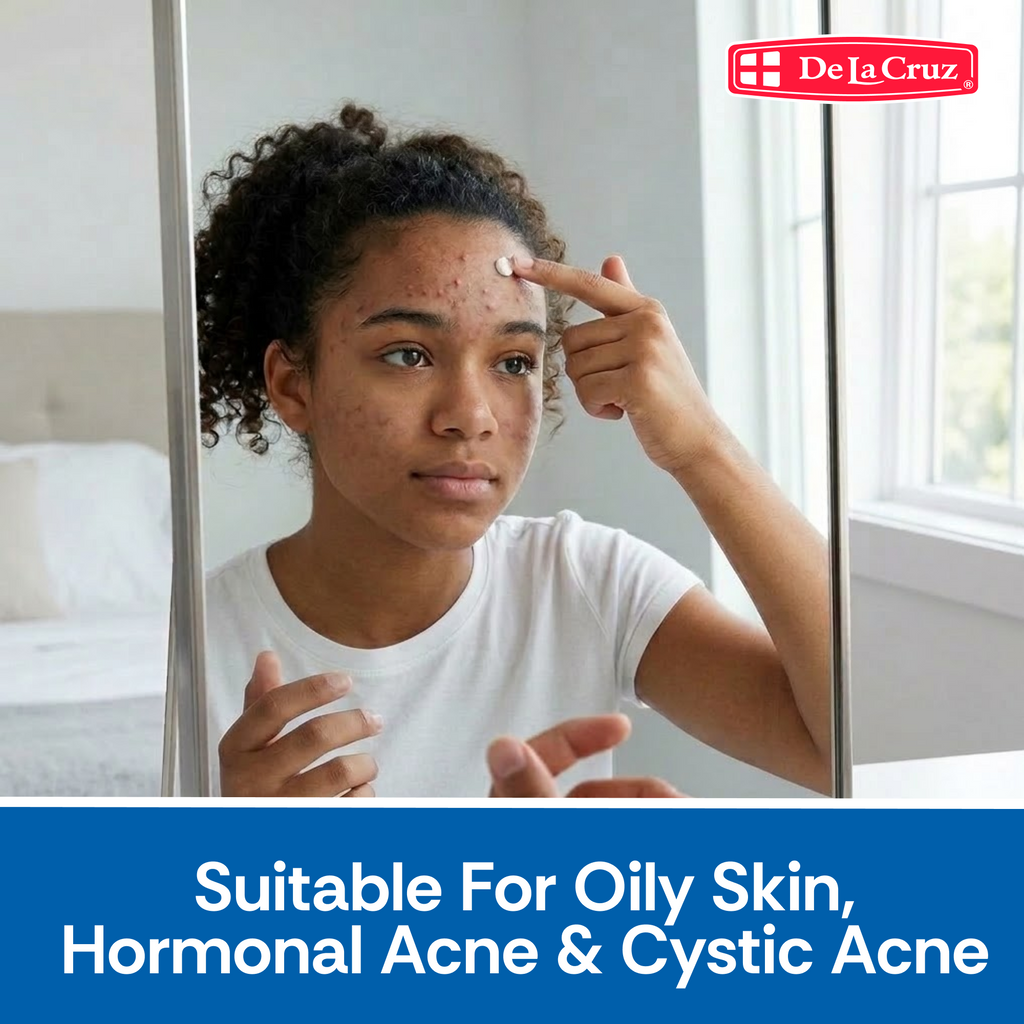 A woman in a white t-shirt looks into a mirror while applying or touching sulfur ointment to her forehead, showing acne blemishes. A red 'De La Cruz' logo is in the top right, and a blue banner at the bottom reads 'Suitable For Oily Skin, Hormonal Acne & Cystic Acne'.