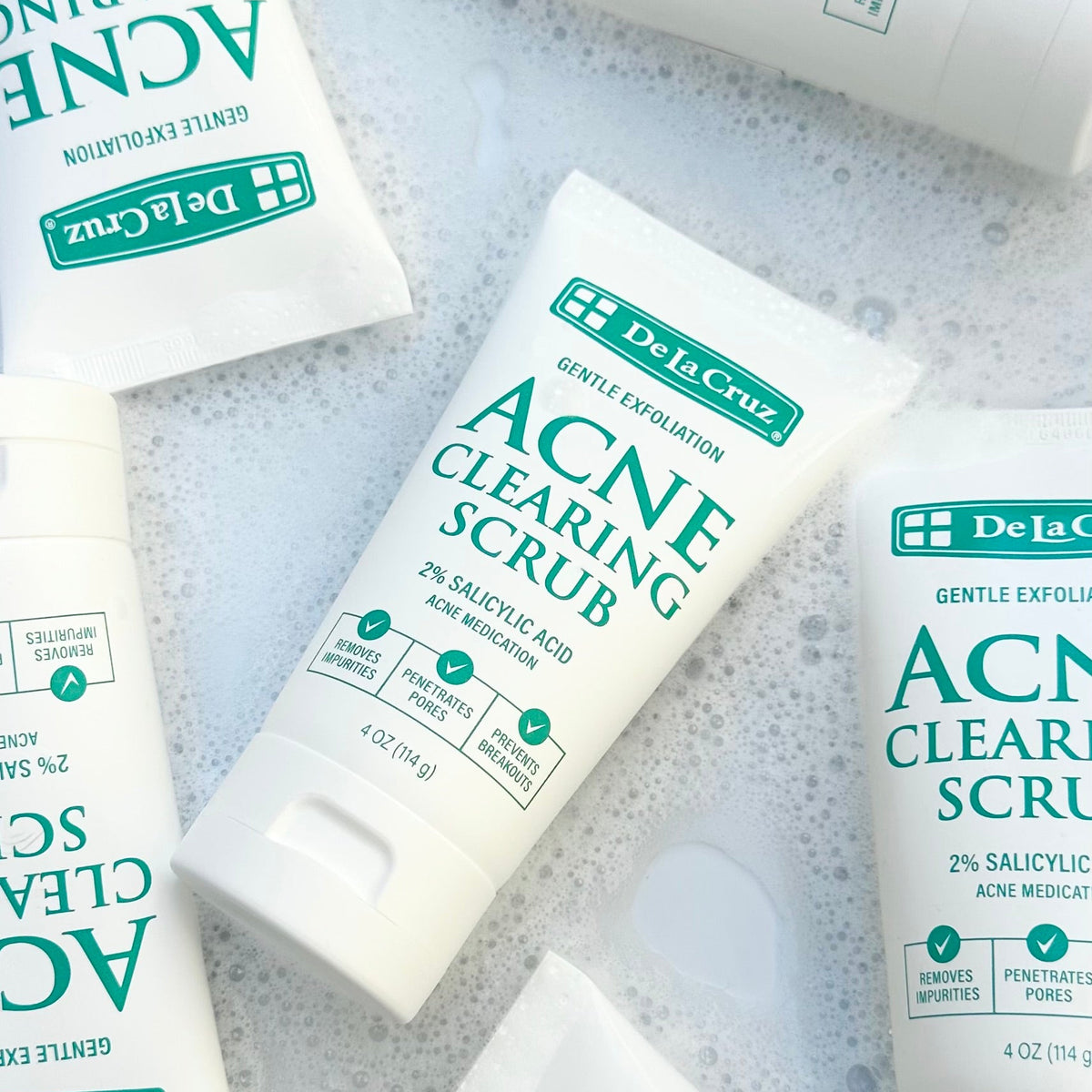 Several white tubes of Dela Cruz Acne Clearing Scrub arranged on a bubbly, light surface. The tubes are printed with green and teal text and branding.