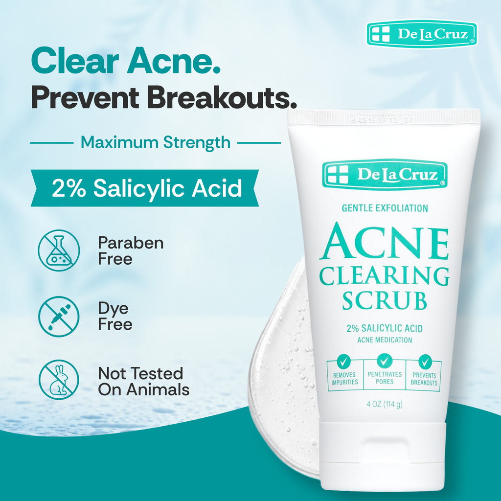De La Cruz Acne Clearing Scrub in a white squeeze tube, shown next to a white drop on a light blue and teal graphic background with product benefits listed on the left.