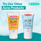 Two De La Cruz Acne Treatment tubes side by side on a light blue and teal background with promotional text reading 'Try Our Other Acne Products.' The left tube is white with an orange/yellow label and says 'Maximum Strength' with 10% sulfur; the right tube is white with a light blue label and says 'For Sensitive Skin' with 5% sulfur.